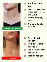 2.webp